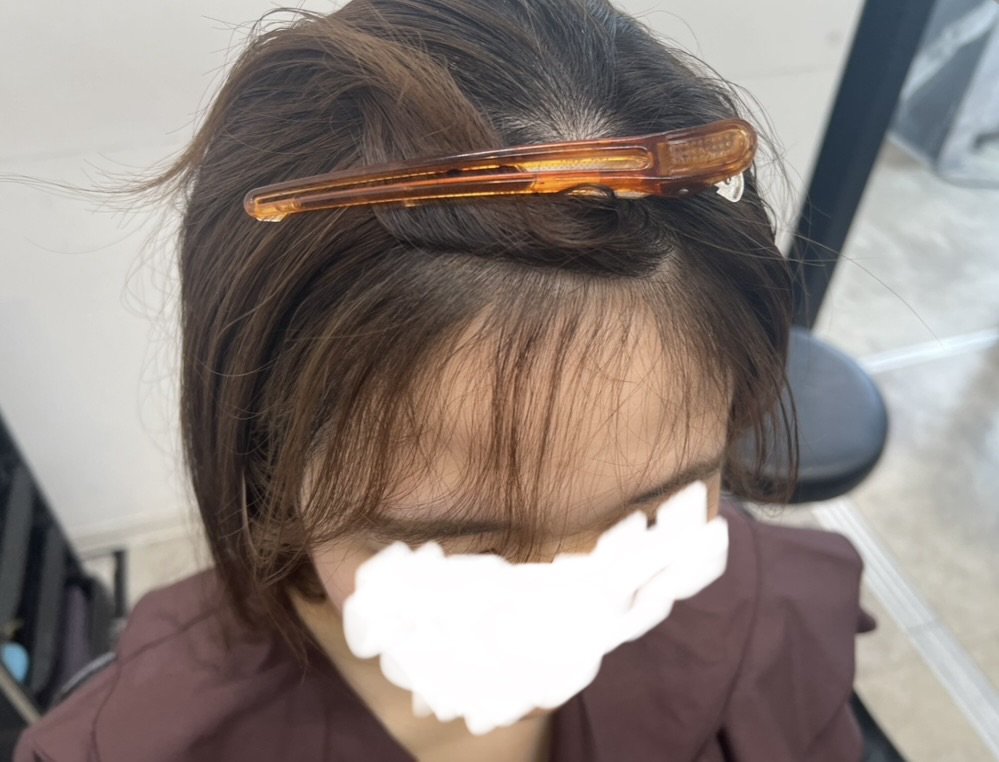 絹女プロ 前髪 before クリップ